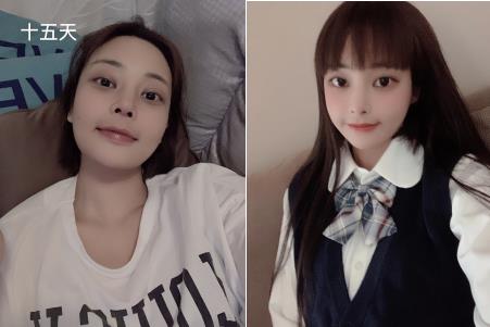 【寧波卓美】你后悔做隆鼻嗎?看完她做的鼻子····