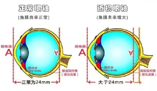 八大處楊欣教授:近視眼可以做雙眼皮手術(shù)嗎?
