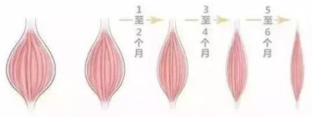 伊美爾愛康醫(yī)院自體脂肪填充效果好不好?