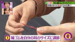 伊美爾愛康醫(yī)院自體脂肪填充效果好不好?