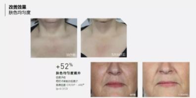 菲洛嘉價(jià)格貴不貴?北京伊美爾紫竹幫你恢復(fù)水潤(rùn)美白