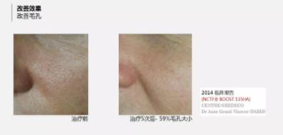 菲洛嘉價(jià)格貴不貴?北京伊美爾紫竹幫你恢復(fù)水潤(rùn)美白