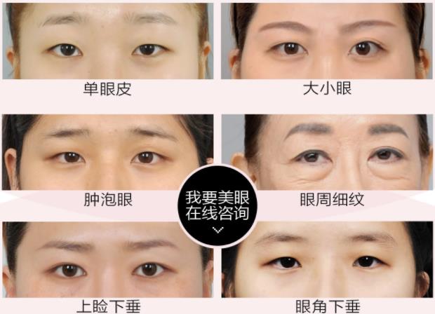 深圳軍科整形做雙眼皮咋樣 每個(gè)愛(ài)美女孩都應(yīng)該來(lái)的地方