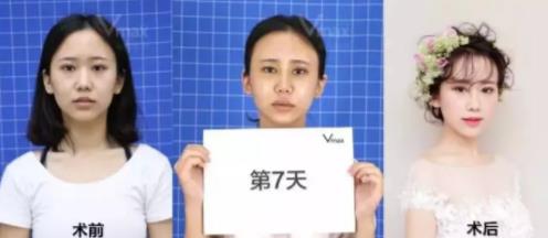 廈門薇格整形醫(yī)院的評價 正規(guī)機構(gòu)超精細化的服務(wù)