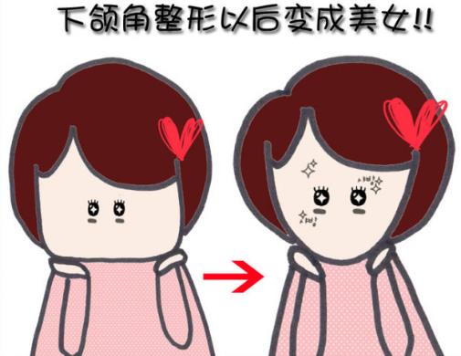 下頜角整形手術(shù)的適應(yīng)癥-下頜角整形手術(shù)的注意事項