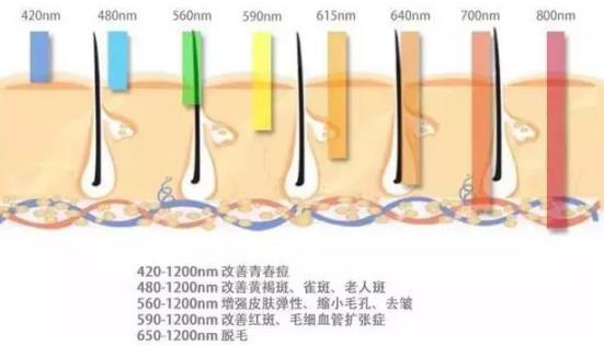北京伊美爾幸福醫(yī)院:光子嫩膚能維持多久