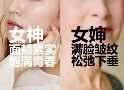 為什么要做線雕提拉?廈門薇格整形醫(yī)院告訴你
