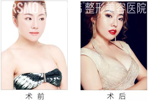 青島華韓整形美容醫(yī)院趙煜楠靠譜嗎 擅長什么手術(shù) 哪些案例