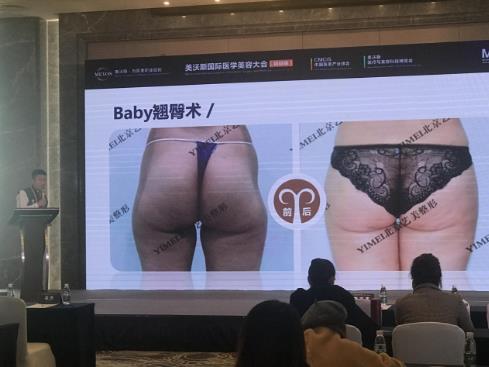 藝美王東整形 年華易逝而美麗永存