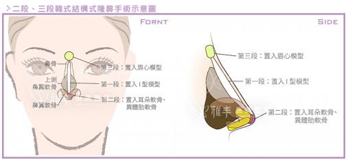 臺灣雅豐醫(yī)美產(chǎn)后隆鼻火熱 整型隆鼻回歸更添自信