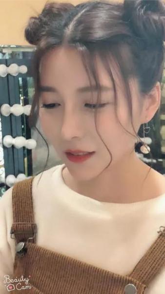廈門薇格整形醫(yī)院:玻尿酸讓她從“干癟火柴妹”變成“精致小姐姐”