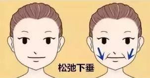 廈門薇格整形醫(yī)院艾莉薇技術(shù):效果長達,12-18個月