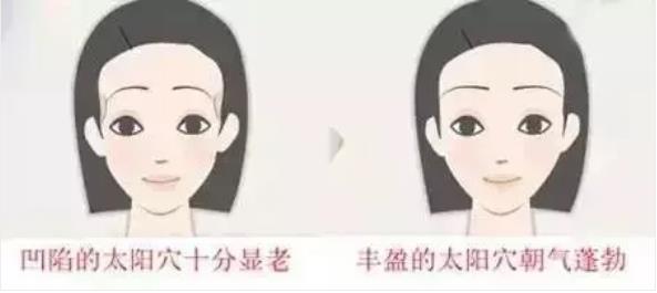 廈門薇格整形醫(yī)院艾莉薇技術(shù):效果長達,12-18個月