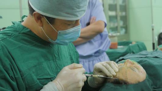 藝美整形王東院長 脂肪填充怎么樣 量身定制打造完美額頭