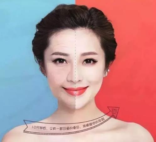 線雕可使面部年齡至少年輕十歲——襄陽華美整形醫(yī)院徐永安