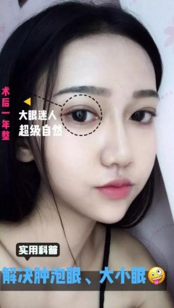 昆明藝星整形專業(yè)嗎 用心雕琢你的美