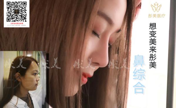 北京彤美隆鼻效果怎么樣 改變未來從變美開始