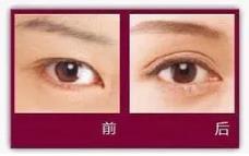 樂(lè)山經(jīng)緯整形醫(yī)院技術(shù)好不好 為你重新定義美麗