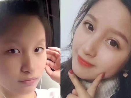 昆明藝星整形做雙眼皮好嗎 美麗獨(dú)秀高貴皇后