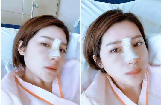 昆明藝星整形正規(guī)可靠么 膚如凝露恢復(fù)鮮潤(rùn)活力