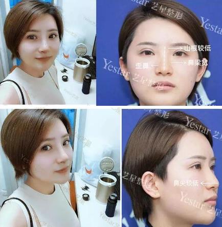 昆明藝星整形正規(guī)可靠么 膚如凝露恢復(fù)鮮潤(rùn)活力