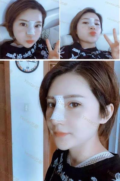 昆明藝星整形正規(guī)可靠么 膚如凝露恢復(fù)鮮潤(rùn)活力