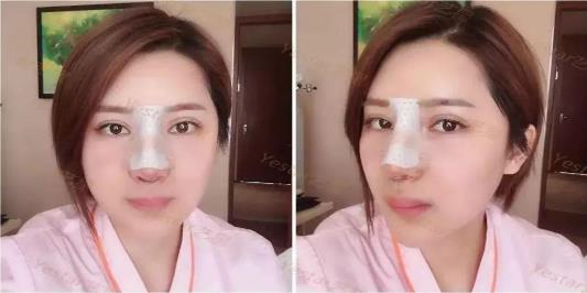 昆明藝星整形正規(guī)可靠么 膚如凝露恢復(fù)鮮潤(rùn)活力