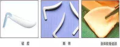 昆明藝星整形正規(guī)可靠么 膚如凝露恢復(fù)鮮潤(rùn)活力