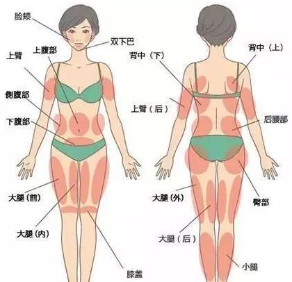 吸脂術(shù)會(huì)反彈嗎 吸脂的后遺癥是什么 吸脂術(shù)不能替代科學(xué)減肥