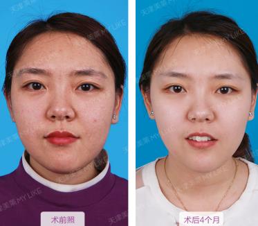 天津美萊醫(yī)院正規(guī)嗎 熱心服務(wù) 真心對待 衷心祝福