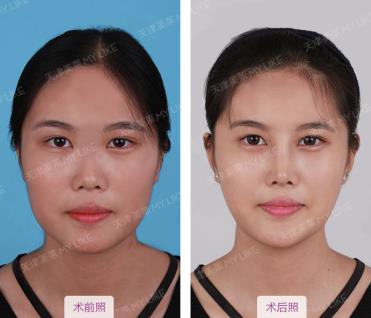 天津美萊醫(yī)院正規(guī)嗎 熱心服務(wù) 真心對待 衷心祝福