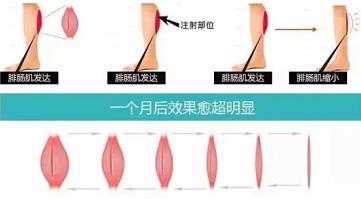 天津河?xùn)|美萊醫(yī)院整形好么 點(diǎn)燃您的靚麗豐采
