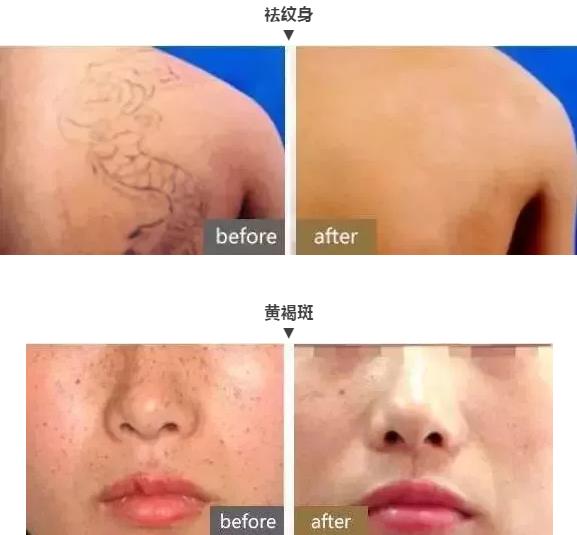 武漢中翰整形醫(yī)院咋樣 技術(shù)一流值得信賴