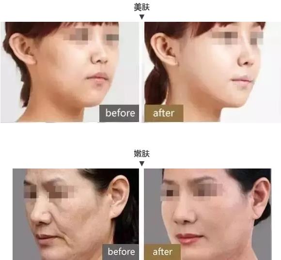 武漢中翰整形醫(yī)院咋樣 技術(shù)一流值得信賴