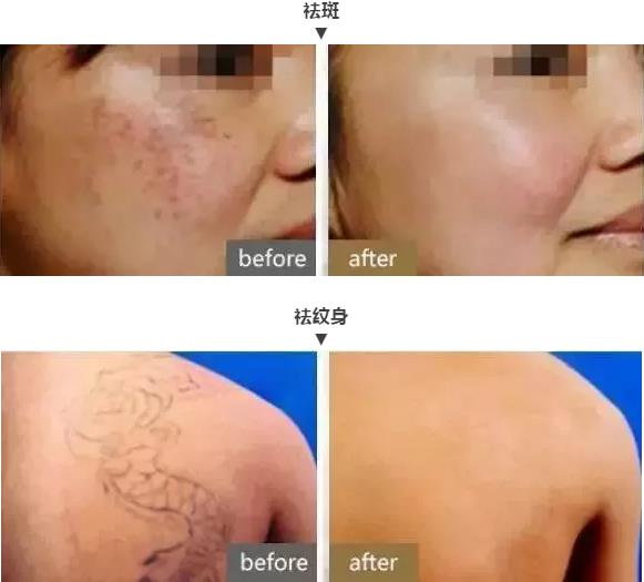 武漢中翰整形醫(yī)院咋樣 技術(shù)一流值得信賴