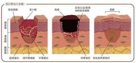 北京伊美爾醫(yī)療醫(yī)院:去疤痕多少錢