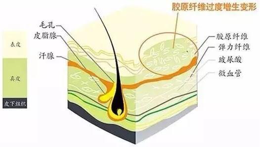 北京伊美爾醫(yī)療醫(yī)院:去疤痕多少錢