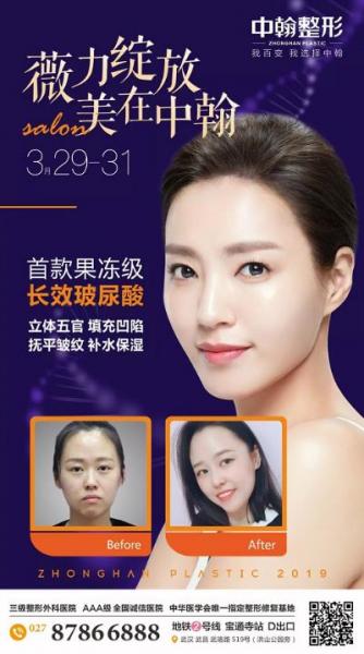 武漢中翰整形醫(yī)院全球招募艾莉薇注射模特啦~