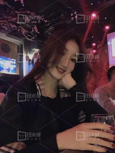 銀川田永成整形做雙眼皮好不好 美是需要“整”理的微整形
