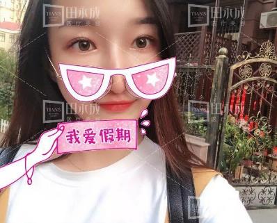銀川田永成整形做雙眼皮好不好 美是需要“整”理的微整形