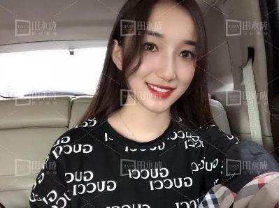 銀川田永成整形做雙眼皮好不好 美是需要“整”理的微整形