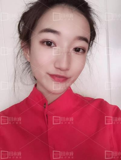 銀川田永成整形做雙眼皮好不好 美是需要“整”理的微整形