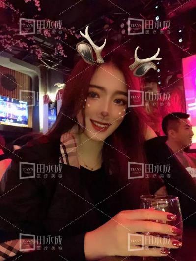 銀川田永成整形做雙眼皮好不好 美是需要“整”理的微整形