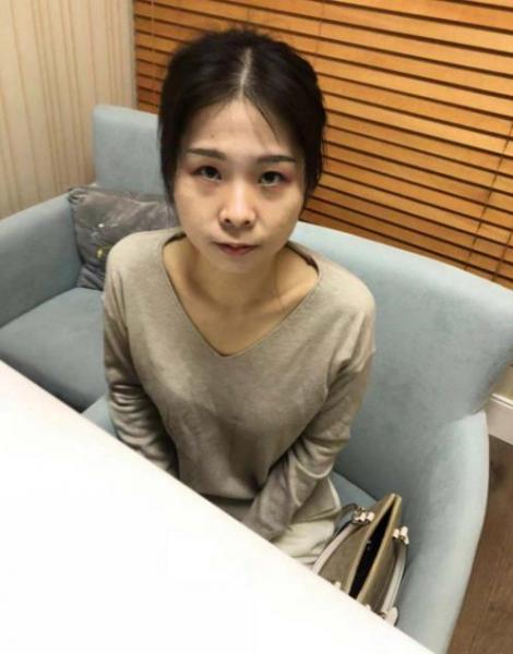深圳米蘭柏羽黎慧娟醫(yī)生做雙眼皮效果怎么樣 遇見完美自己