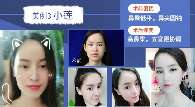 廣州韓妃歐陽春院長——站在巨人肩膀上的巨匠