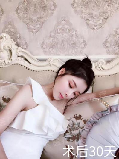 喜美科普誰做過隆鼻修復手術?采用什么方案較好?