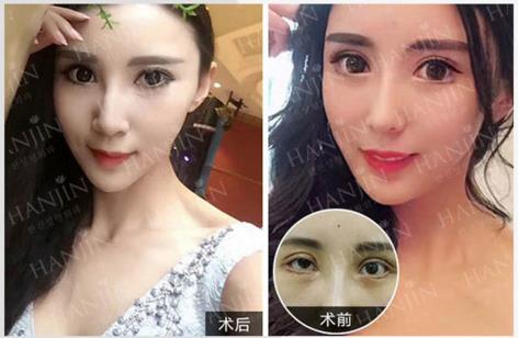 昆明韓辰楊瑞年院長 整形醫(yī)生也要講醫(yī)德