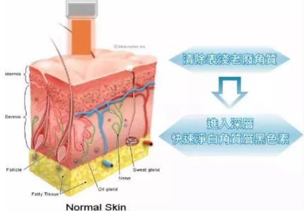 北京伊美爾健翔醫(yī)院:玻尿酸除皺的價(jià)格