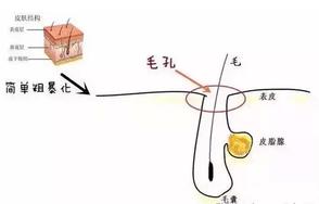 北京伊美爾愛康醫(yī)院: 點陣激光多久恢復(fù)
