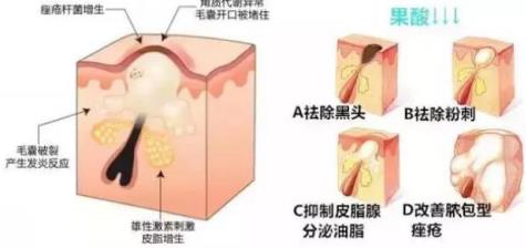 北京伊美爾健翔醫(yī)院:玻尿酸除皺的價(jià)格